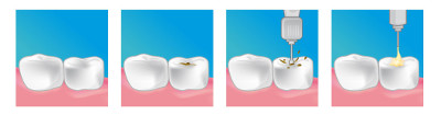 dentiste haguenau