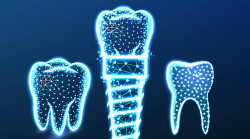dents fluorescentes centre dentaire haguenau 
